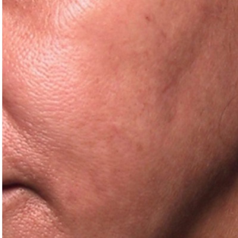 Check _Asian skin_after-01