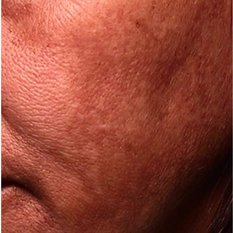Check _Asian skin_before-01