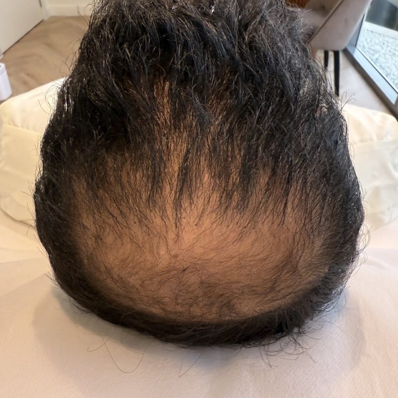 before-2.jpg